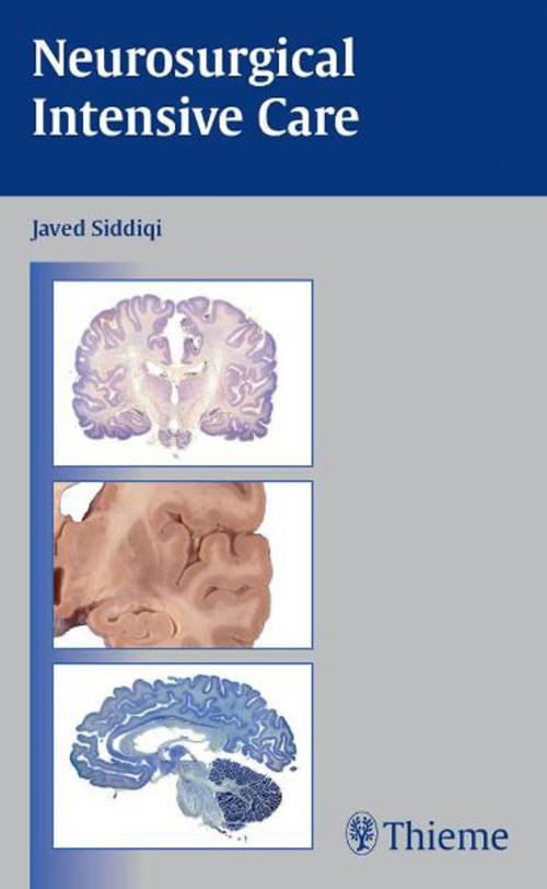 Cover of the book Neurosurgical Intensive Care by , Thieme