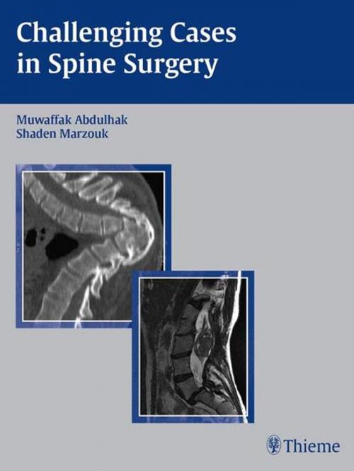 Cover of the book Challenging Cases in Spine Surgery by , Thieme