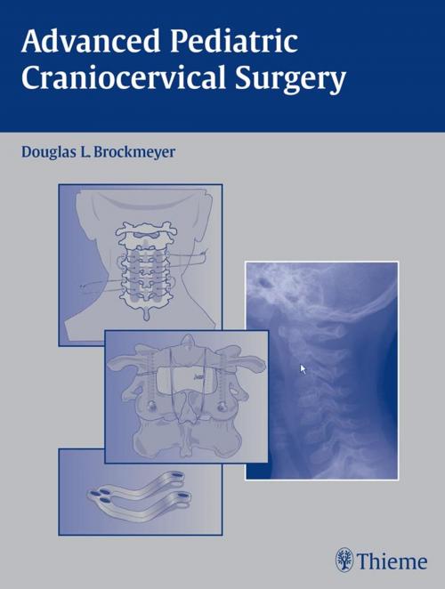 Cover of the book Advanced Pediatric Craniocervical Surgery by , Thieme