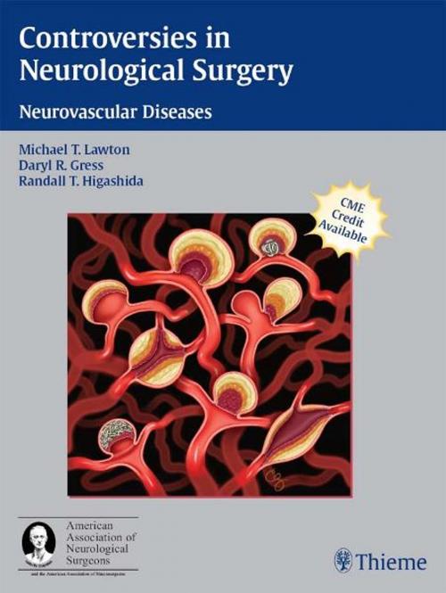 Cover of the book Controversies in Neurological Surgery by , Thieme