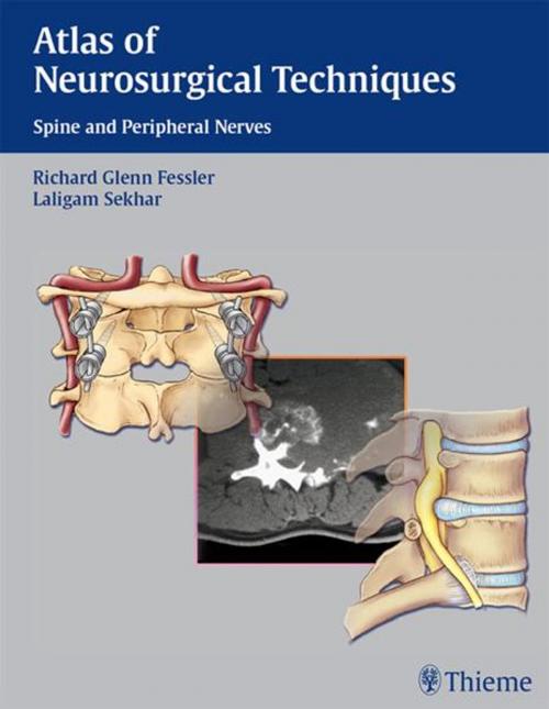 Cover of the book Atlas of Neurosurgical Techniques by , Thieme