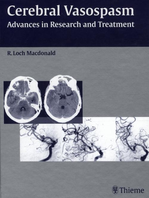 Cover of the book Cerebral Vasospasm by R. Loch Macdonald, Thieme