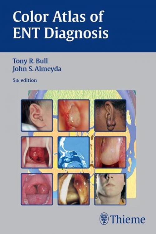 Cover of the book Color Atlas of ENT Diagnosis by Tony R. Bull, John S. Almeyda, Thieme
