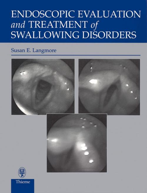 Cover of the book Endoscopic Evaluation and Treatment of Swallowing Disorders by Susan Langmore, Thieme