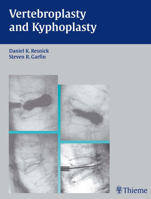 Cover of the book Vertebroplasty and Kyphoplasty by , Thieme
