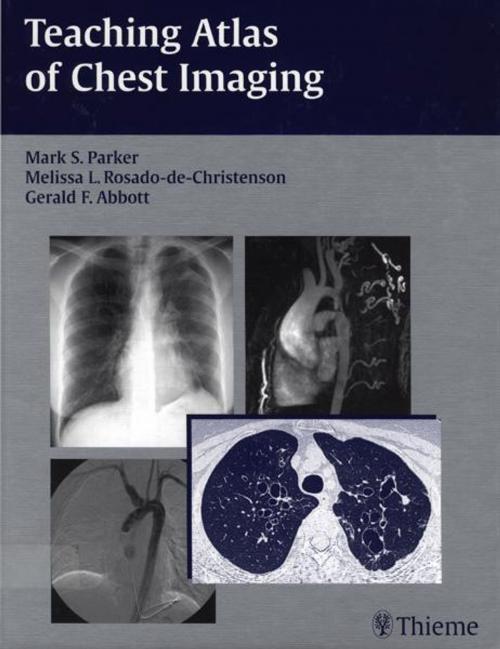 Cover of the book Teaching Atlas of Chest Imaging by Mark S. Parker, Melissa L. Rosado-de-Christenson, Gerald F. Abbott, Thieme