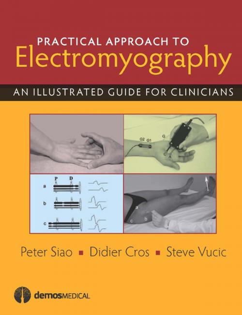 Cover of the book Practical Approach to Electromyography by Dr. Didier Cros, MD, Peter Siao, MD, Dr. Steve Vucic, MBBS, PhD, FRACP, Springer Publishing Company