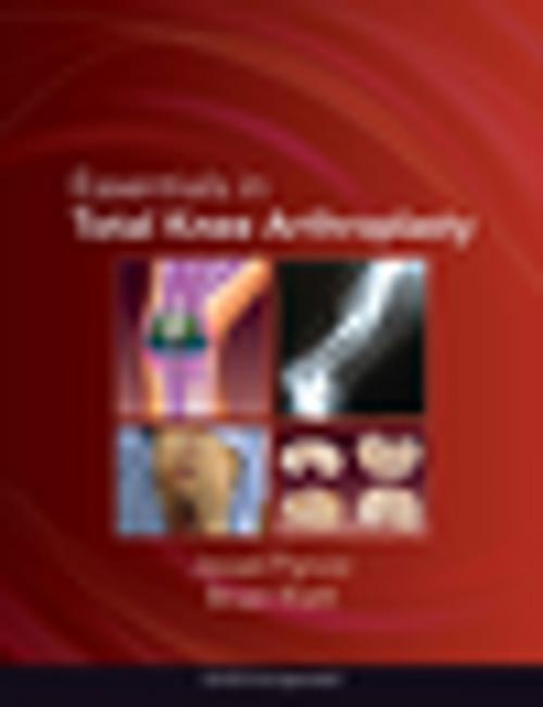 Cover of the book Essentials in Total Knee Arthroplasty by , SLACK Incorporated