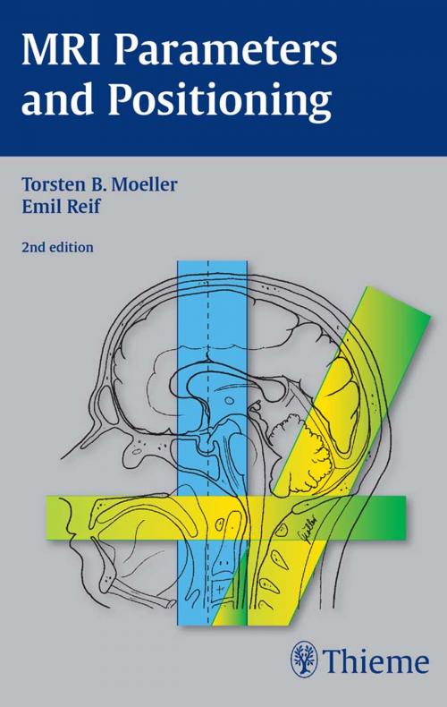 Cover of the book MRI Parameters and Positioning by Emil Reif, Torsten Bert Moeller, Thieme