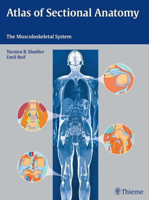 Cover of the book Atlas of Sectional Anatomy by Emil Reif, Torsten Bert Moeller, Thieme