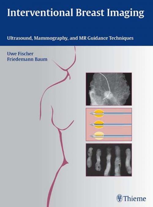 Cover of the book Interventional Breast Imaging by Uwe Fischer, Friedemann Baum, Thieme