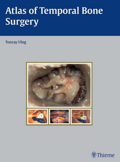 Cover of the book Atlas of Temporal Bone Surgery by Tuncay Ulug, Thieme