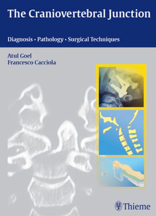 Cover of the book Craniovertebral Junction by Atul Goel, Francesco Cacciola, Thieme
