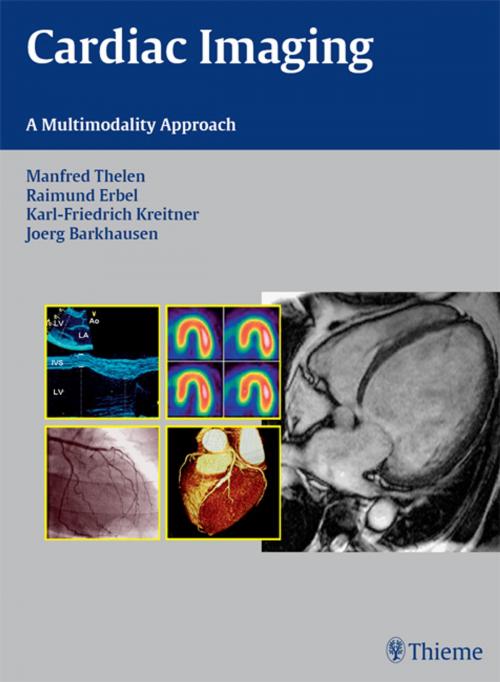 Cover of the book Cardiac Imaging by Manfred Thelen, Raimund Erbel, Karl-Friedrich Kreitner, Thieme