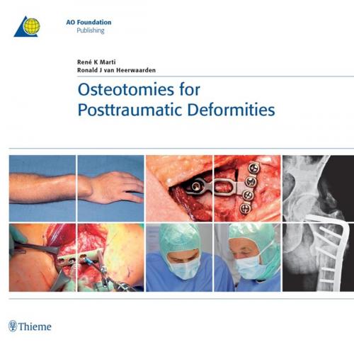 Cover of the book Osteotomies for Posttraumatic Deformities by Ren K. Marti, Ronald J. van Heerwaarden, Thieme/AO