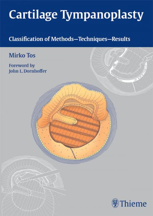 Cover of the book Cartilage Tympanoplasty by Mirko Tos, Thieme