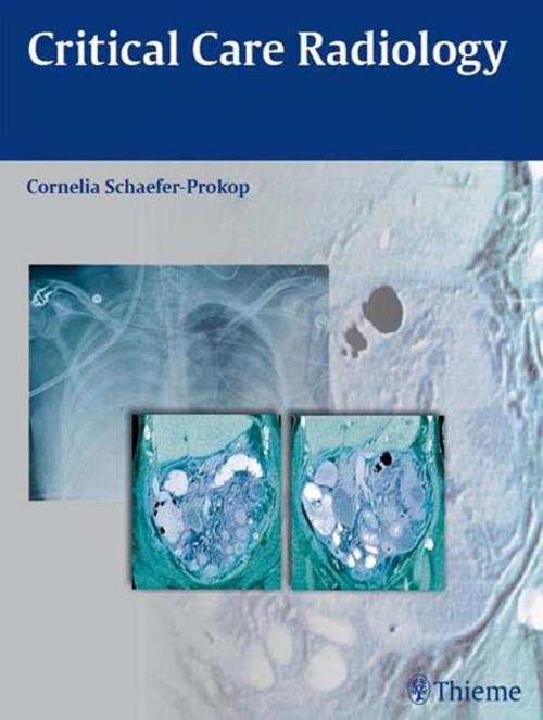 Cover of the book Critical Care Radiology by Cornelia Schaefer-Prokop, Thieme