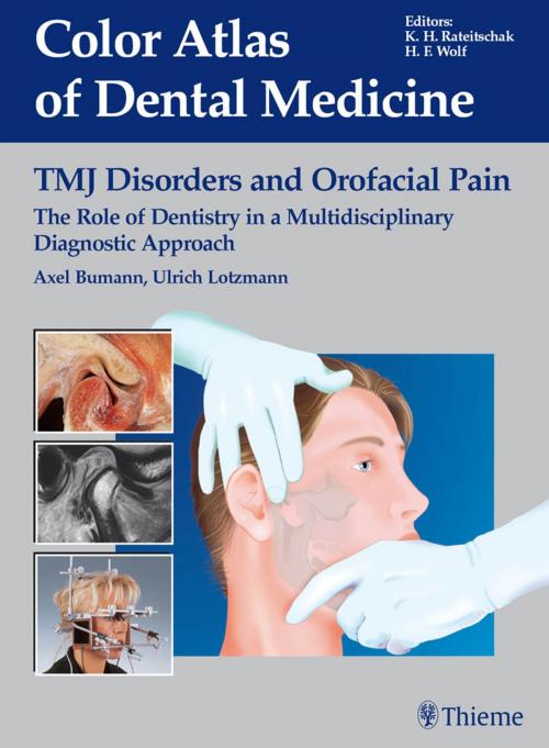 Cover of the book TMJ Disorders and Orofacial Pain by Axel Bumann, Ulrich Lotzmann, Thieme