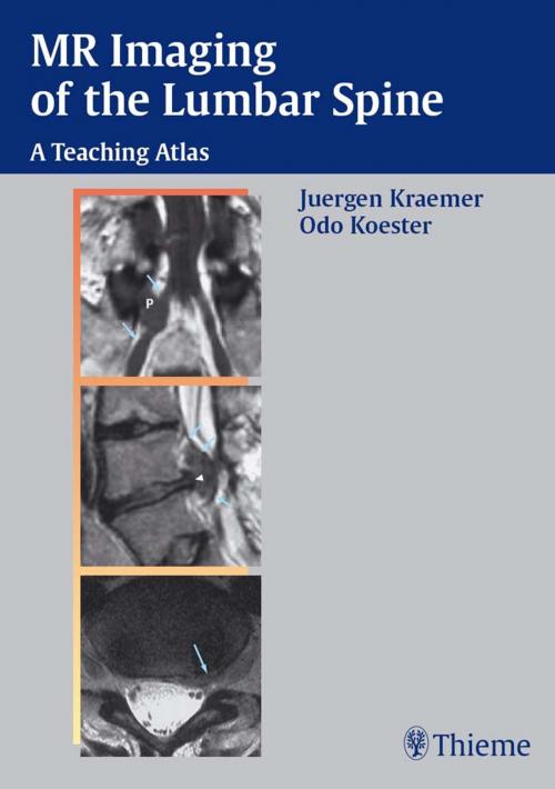 Cover of the book MR Imaging of the Lumbar Spine by Juergen Kraemer, Odo Koester, Thieme
