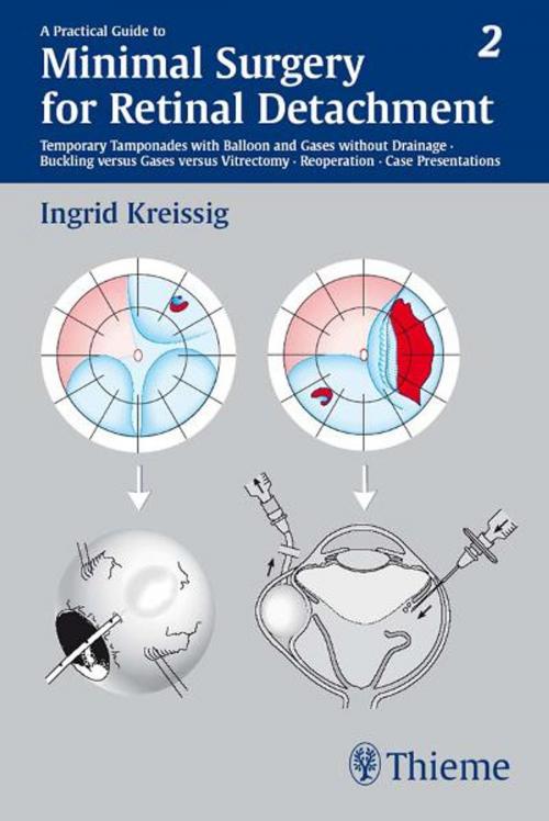 Cover of the book Practical Guide to Minimal Surgery for Retinal Detachment, Volume II by Ingrid Kreissig, Thieme