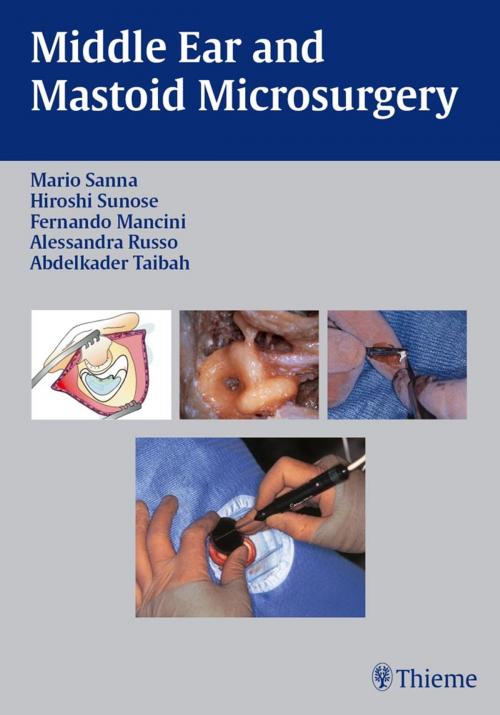 Cover of the book Middle Ear and Mastoid Microsurgery by Mario Sanna, Hiroshi Sunose, Thieme
