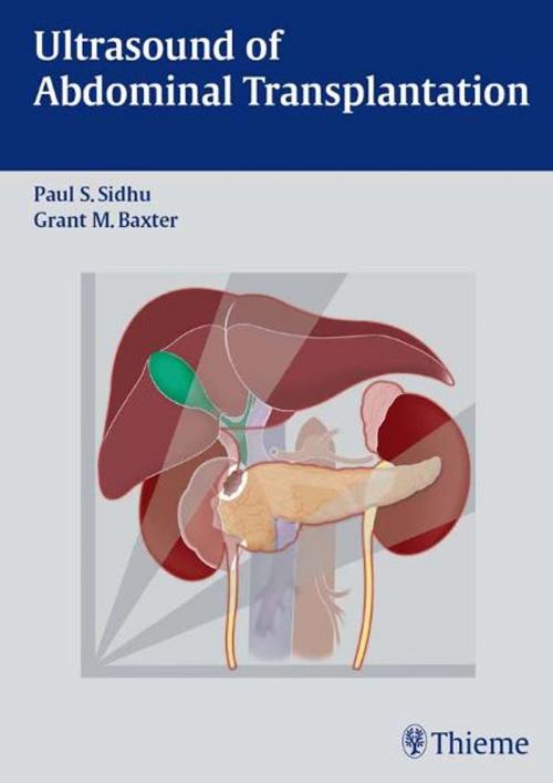 Cover of the book Ultrasound of Abdominal Transplantation by , Thieme