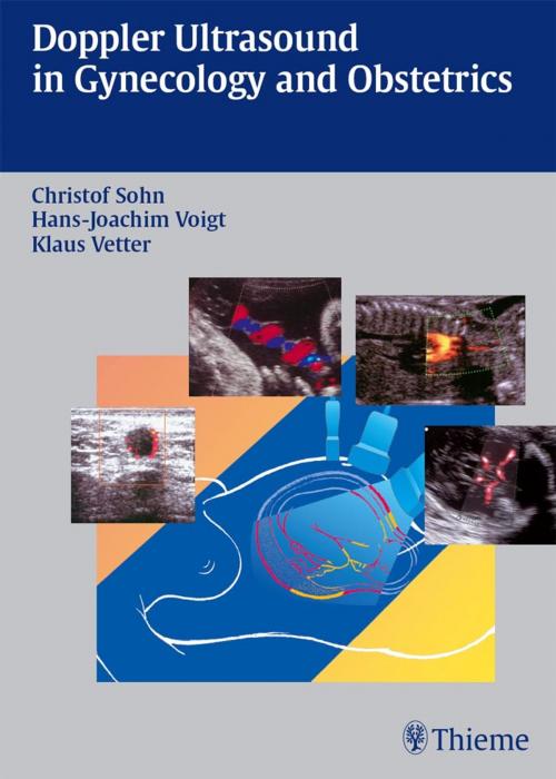 Cover of the book Doppler Ultrasound in Gynecology and Obstetrics by Christof Sohn, Klaus Vetter, Hans-Joachim Voigt, Thieme