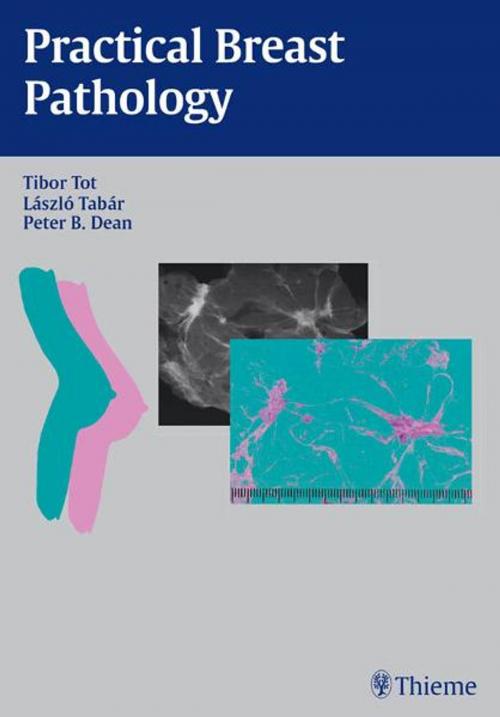 Cover of the book Practical Breast Pathology by Tibor Tot, Laszlo Tabar, Peter B. Dean, Thieme