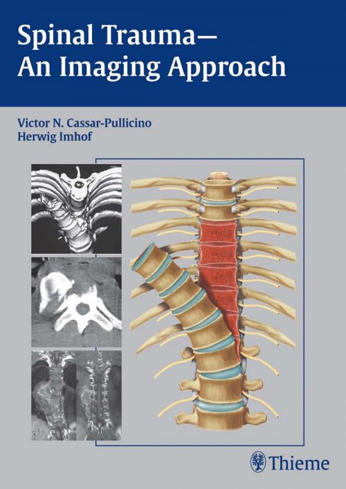 Cover of the book Spinal Trauma - An Imaging Approach by Herwig Imhof, Victor N. Cassar-Pullicino, Thieme