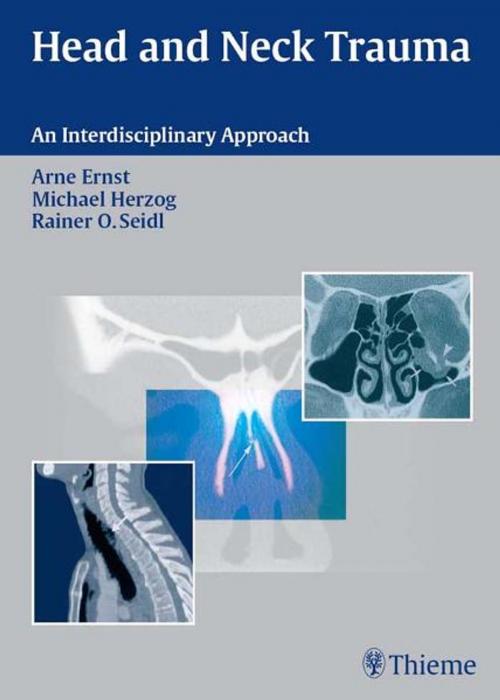 Cover of the book Head and Neck Trauma by Arne Ernst, Michael Herzog, Thieme