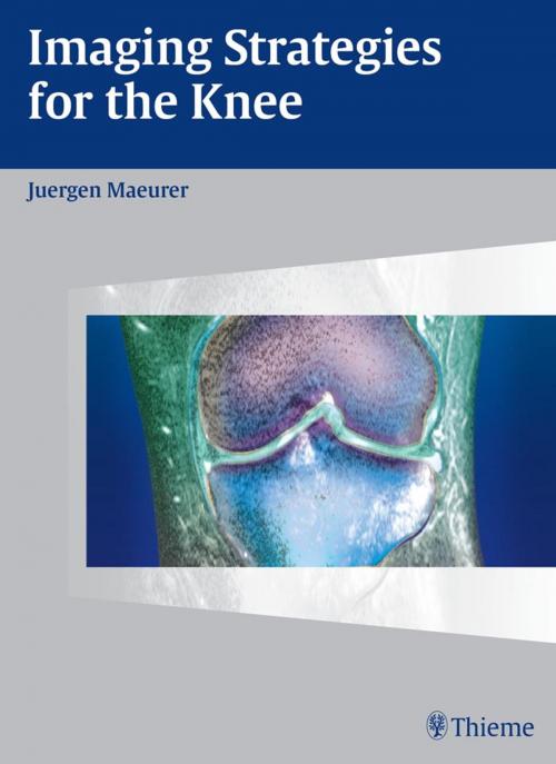 Cover of the book Imaging Strategies for the Knee by Juergen Maeurer, Thieme