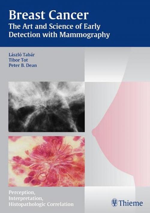 Cover of the book Breast Cancer - The Art and Science of Early Detection with Mammography by Laszlo Tabar, Tibor Tot, Peter B. Dean, Thieme