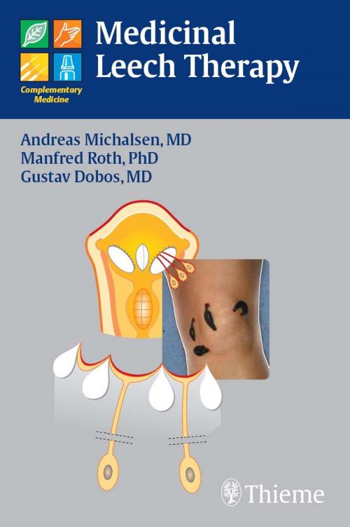 Cover of the book Medicinal Leech Therapy by Andreas Michalsen, Manfred Roth, Gustav J. Dobos, Thieme