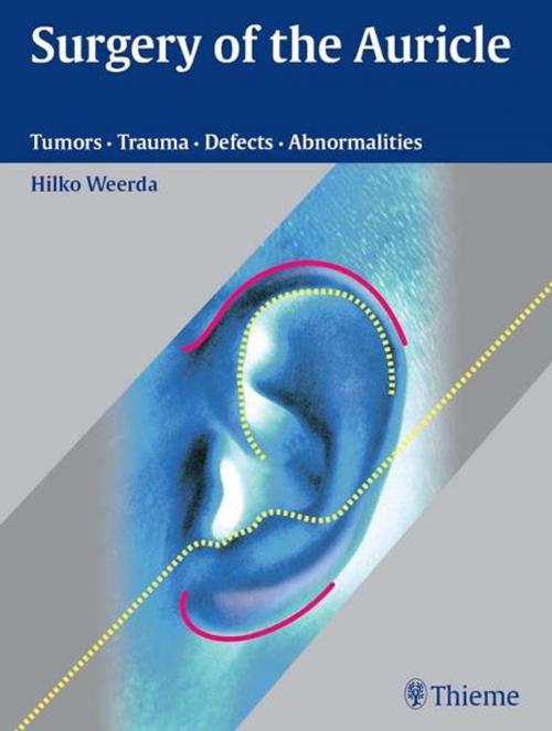 Cover of the book Surgery of the Auricle by Hilko Weerda, Thieme