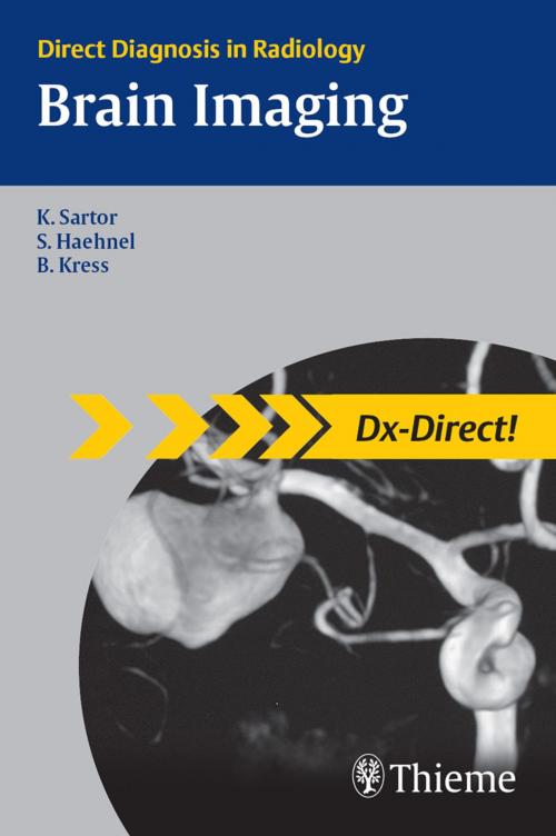 Cover of the book Brain Imaging by Klaus Sartor, Stefan Haehnel, Thieme