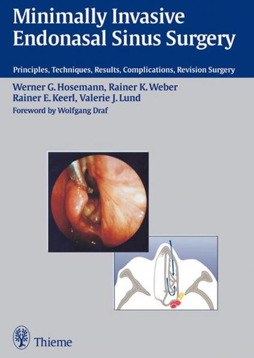 Cover of the book Minimally Invasive Endonasal Sinus Surgery by Werner Goetz Hosemann, R. K. Weber, Thieme