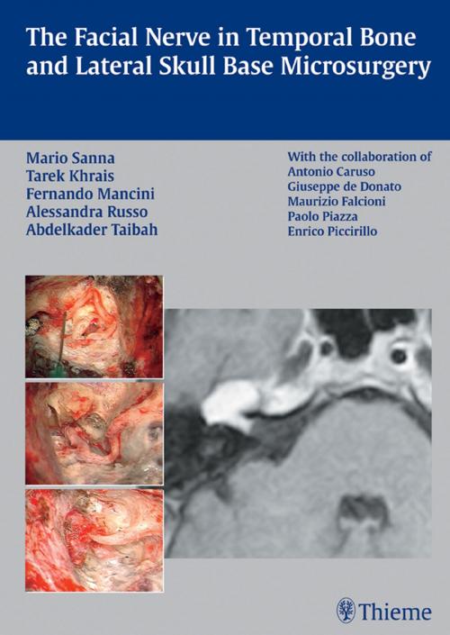 Cover of the book Facial Nerve in Temporal Bone and Lateral Skull Base Microsurgery by Mario Sanna, Tarek Khrais, Fernando Mancini, Thieme