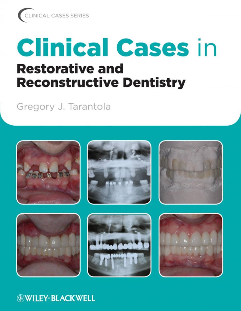 Big bigCover of Clinical Cases in Restorative and Reconstructive Dentistry