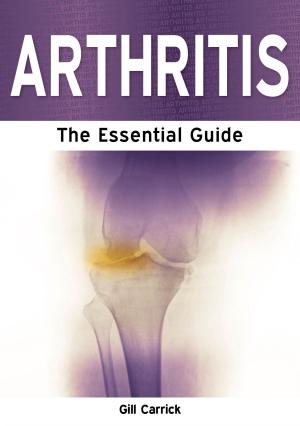 Book cover of Arthritis: The Essential Guide