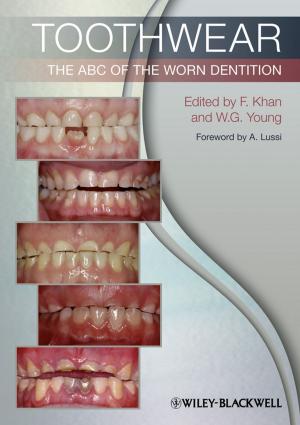 Cover of the book Toothwear by Freek Rhebergen, Joseph Botting