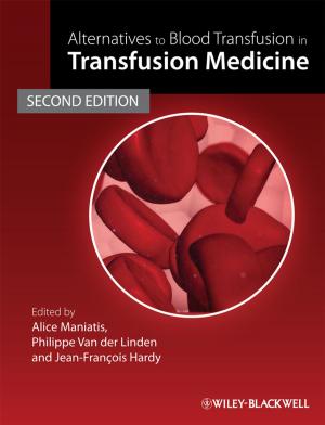 Cover of the book Alternatives to Blood Transfusion in Transfusion Medicine by 