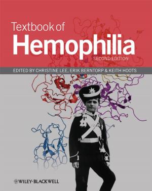 Cover of the book Textbook of Hemophilia by Guillaume Houzeaux, Frédéric Magoules, François-Xavier Roux