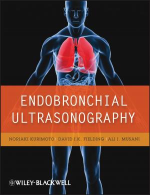 Cover of the book Endobronchial Ultrasonography by Allyson Kapin, Amy Sample Ward