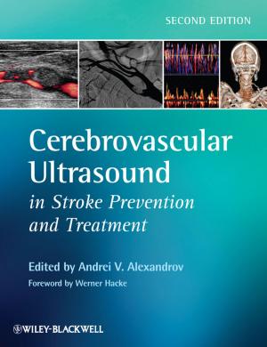 Cover of the book Cerebrovascular Ultrasound in Stroke Prevention and Treatment by John Steventon