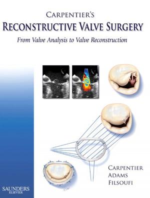 Cover of the book Carpentier's Reconstructive Valve Surgery E-Book by Yoram G. Weiss, Micha Y. Shamir