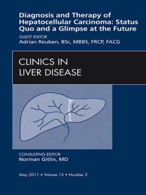 Cover of the book Hepatocellular Carcinoma, An Issue of Clinics in Liver Disease - E-Book by Deborah R. Shatzkes, MD