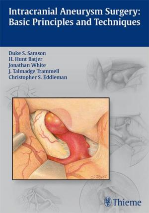 Cover of Intracranial Aneurysm Surgery