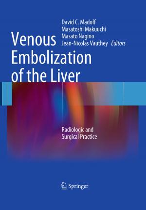 Cover of the book Venous Embolization of the Liver by Norman Johnson, Anton Louis Pozniak