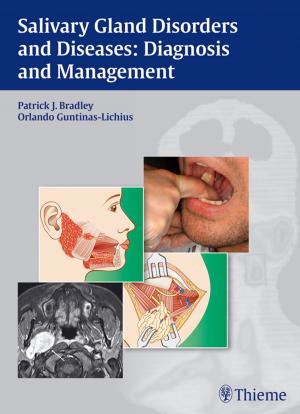 Cover of the book Salivary Gland Disorders and Diseases: Diagnosis and Management by Michael S. Godin