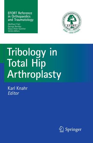 Cover of the book Tribology in Total Hip Arthroplasty by Gabriele Buck, Simone Claudi-Böhm, Gudrun Jütting, Bernhard Böhm, Wolfgang E. Paulus, Helmut Kleinwechter